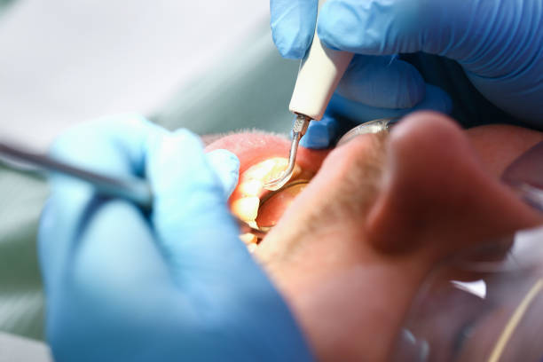 Best After-Hours Dental Trauma Care in Golden Triangle, NJ