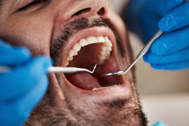 Best Same-Day Emergency Dental Services in Golden Triangle, NJ