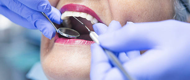 Best Emergency Tooth Extraction in Golden Triangle, NJ